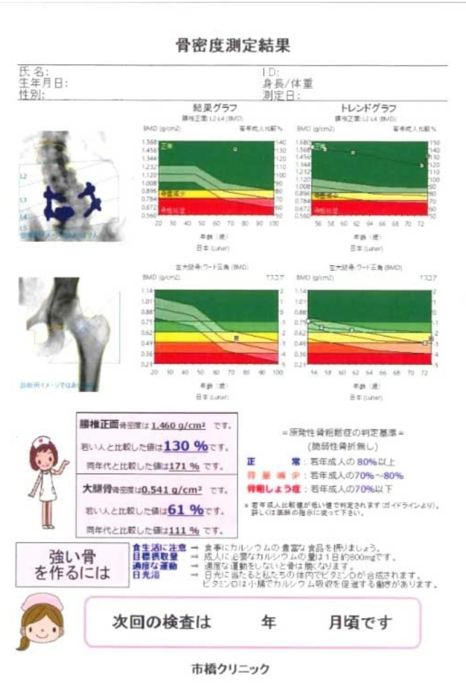 骨密度測定検査 DXA